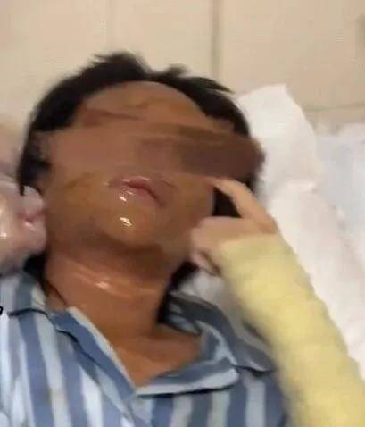 怎么开通皇冠信用網口
_女主播称遭伪装快递包裹炸伤怎么开通皇冠信用網口
，湖南警方通报